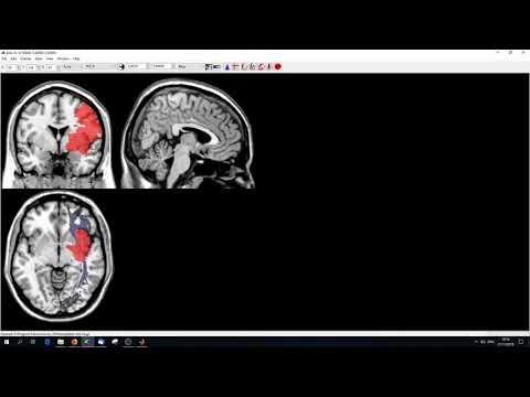 Methods in Neuropsychology Tübingen - Tutorial 3 Working with Brain Imaging in MATLAB/SPM