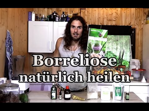 Der beste Chirurg für eine Hüftoperation Posttraumatische Arthrose des Ellenbogengelenks von ICD-10