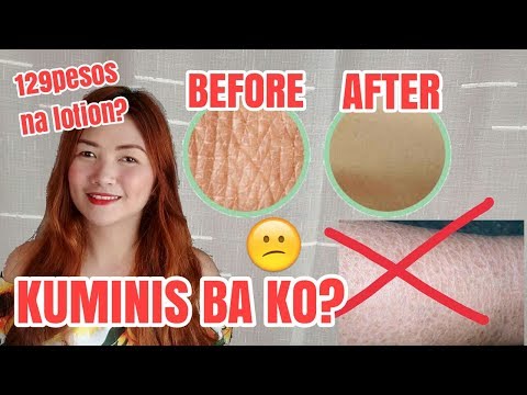 Ikansela ang OK at slimming Isang doktor ay nakakatulong upang mawalan ng timbang