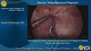 Subcutaneous Onlay Laparoscopic Approach For Repair of Ventral Hernia and Diastasis Recti