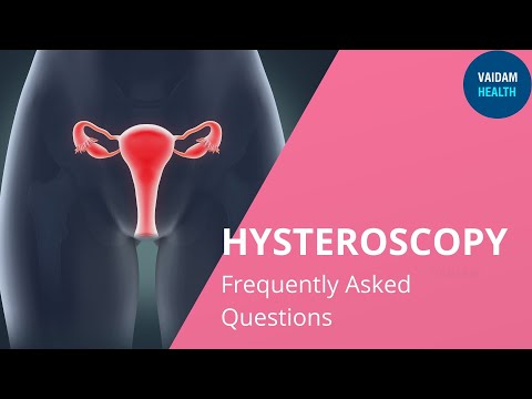 Hysteroscopy- Frequently Asked Questions