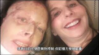 Download lagu 照鏡子認不得自己 61歲婦記憶困在1970年代 mp3 Download lagu 照鏡子認不得自己 61歲婦記憶困在1970年代 mp3