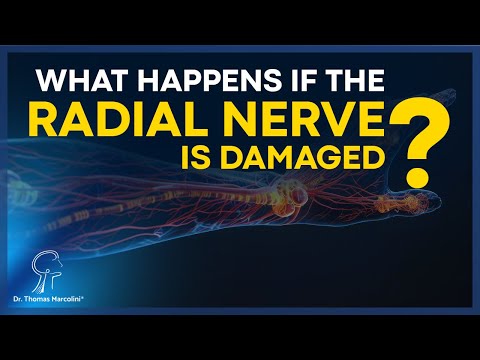 Radial Nerve Injury? Warning Signs, Causes & the Best Treatments You Need to Know!