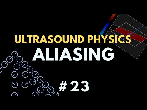 Aliasing Artifact | Ultrasound Physics Course | Radiology Physics Course #23