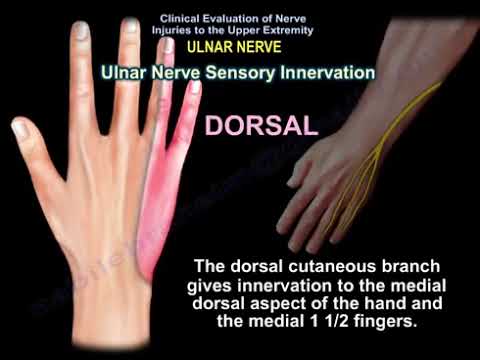 Lesión del nervio cubital: Causas, síntomas, diagnóstico y tratamiento