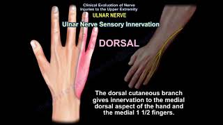 ULNAR NERVE INJURY ,CAUSES ,SYMPTOMS ,DIAGNOSIS  AND TREATMENT. Cubital tunnel syndrome.