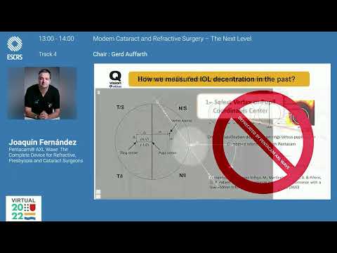 Modern Cataract and Refractive Surgery – The next level Pentacam® AXL Wave, K5M and Corvis® ST