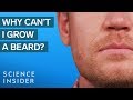 Why Some Men Can't Grow Beards