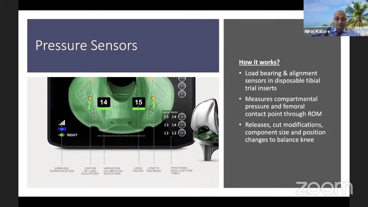 Newer Technology in Knee Replacement