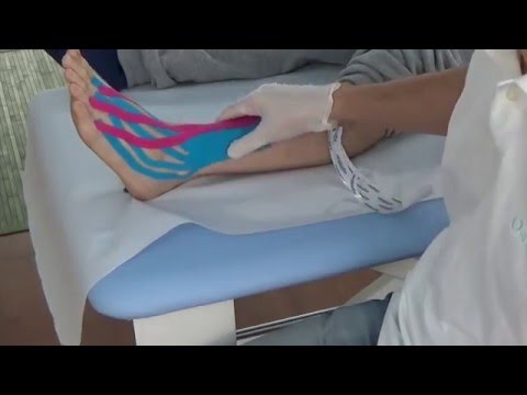 Mal di schiena periodica durante la gravidanza Trattamento dellartrosi delle articolazioni dellanca di 1 grado