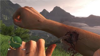 Far Cry 3 Health System (All Injuries)