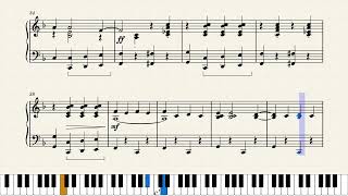 Tom Lehrer - So Long, Mom (A Song for World War III)