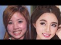 โบท็อก ที่ไหนดี