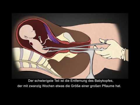 Cinquefoil 911 Balsam für gemeinsame Bewertungen Preis Schmerzen in den Gelenken der Hände und Füße Analysen