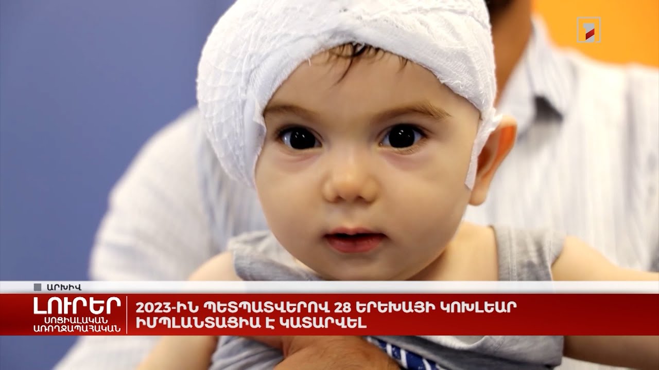 2023-ին պետպատվերով 28 երեխայի կոխլեար իմպլանտացիա է կատարվել