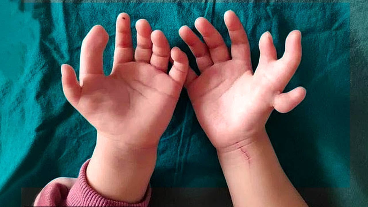 People Born With Crazy Mutations