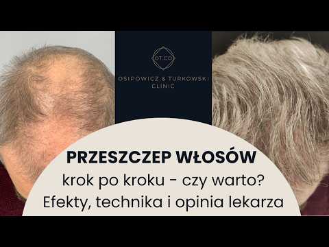 Piotr  Turkowski-46
