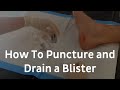 How To Puncture And Drain A Blister | Blister Treatment
