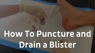 How To Puncture And Drain A Blister | Blister Treatment