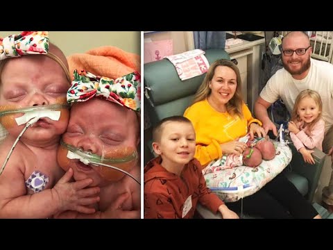 Preemie Twins Born at 22 Weeks Are Breaking Records