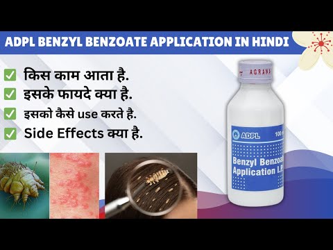 Adpl Benzyl Benzoate Application Ip | Benzyl Benzoate Application Ip in Hindi | how To Use | Price