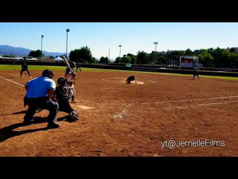 A Pitcher Got Seriously Injured, Being Helped by Coaches Back to the Dugout! 🙏She will be OK.