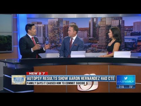 Valley doctor talks about CTE after autopsy revealed Aaron Hernandez had this disease