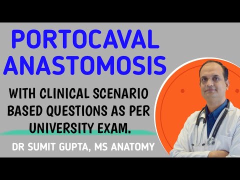 PORTOCAVAL ANASTOMOSIS
