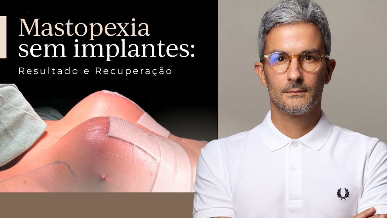 Tudo que você precisa saber - Mastopexia Sem Implantes