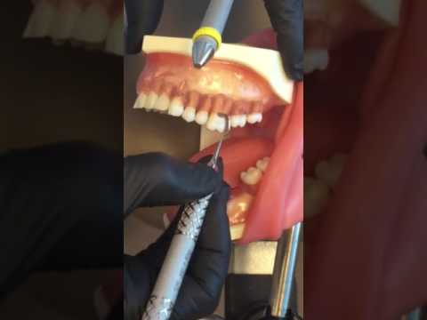 Professor Norrell: Use of Columbia 13/14 Universal Curet