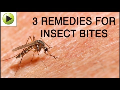 Insect Bites - Natural Ayurvedic Home Remedies