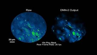 Newswise:Video Embedded from-blurry-to-bright-ai-tech-helps-researchers-peer-into-the-brains-of-mice