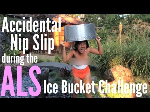 Accidental Nip Slip during ALS Ice Bucket Challenge 