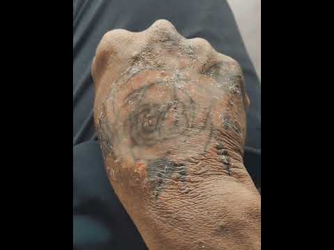 my tattoo damage 😔😭