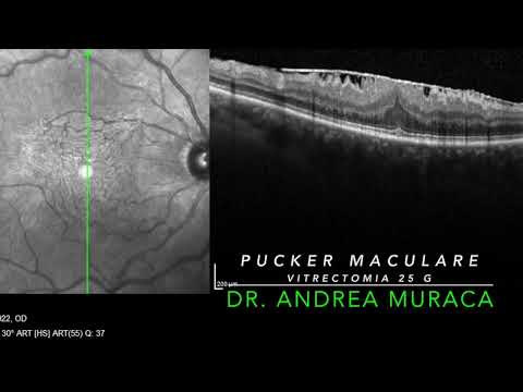Andrea Muraca-8