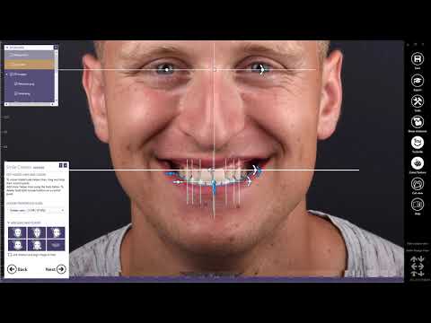 Carestream CS 3700 Dental Intraoral Scanner intro video