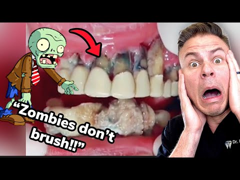 If Zombies Went To The Dentist