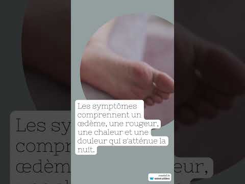 Vidéo : panaris du doigt — symptômes et traitement