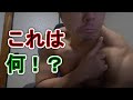 【ライブ】このアザは虐待!?