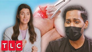 Complete Toenail Removal: Dr. Sarah Removes Nail After Traumatic Fungus | My Feet Are Killing Me