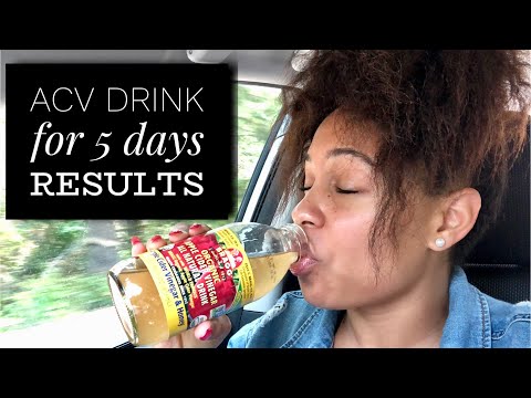 download lagu mp3 mp4 Apple Cider Vinegar For Weight Loss Quora, download lagu Apple Cider Vinegar For Weight Loss Quora gratis, unduh video klip Apple Cider Vinegar For Weight Loss Quora