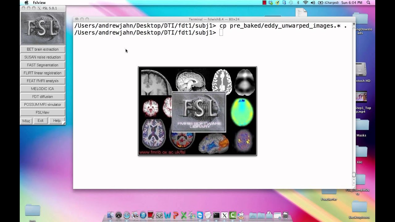 DTI Analysis, Step 2: Run Eddy