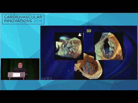 CVI2018 Session: TEE imaging for procedure planning - Richard Bae, MD