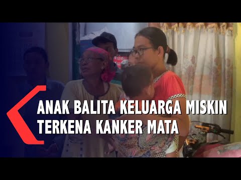 Anak Balita Keluarga Miskin Terkena Kanker Mata