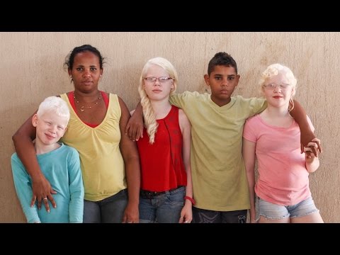 My Albino Children: Black Brazilian Family Have Three White-Skinned Children