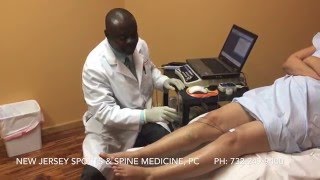 EMG "Nerve Test" Procedure explained by Dr. Ankamah at New Jersey Sports & Spine Medicine, PC