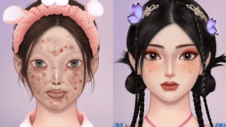 Download lagu ✨From Blemished to Beautiful | ASMR Acne to Angelic Beauty Transformation 💖🧴 mp3 Download lagu ✨From Blemished to Beautiful | ASMR Acne to Angelic Beauty Transformation 💖🧴 mp3