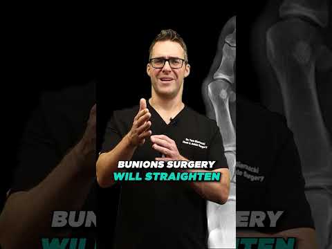 BEST 25 Plantar Fasciitis HOME Treatments Massage Stretches Shoes