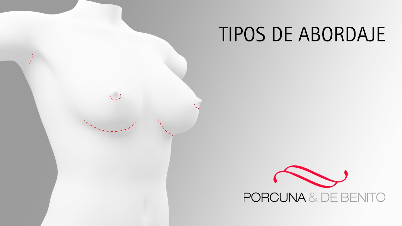 Watch Los tipos de abordaje Now Los tipos de abordaje