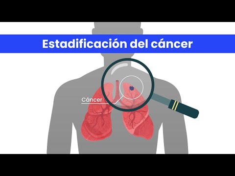 ¿Por qué es importante la estadificación del cáncer de pulmón?